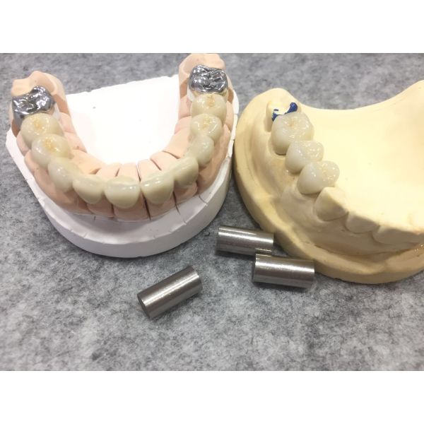 Yield Strength 500MPa Nickel Chrome Alloy Biocompatibility Certified Fused To