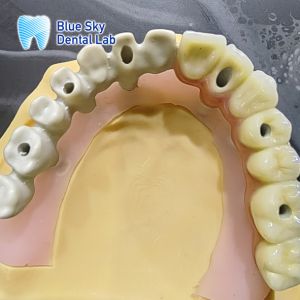 Customize Color Implant Cases with Smooth Surface Nature Design for Universal