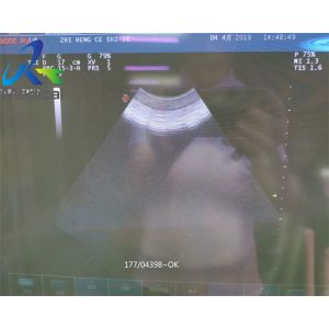 CA431 convex probe ultrasound For Abdominal Vascular ultrasonic cleaning probe