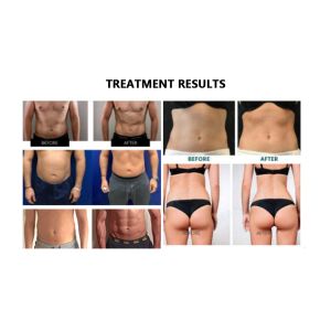 Electronic Muscle Stimulator Machine Ems Neo Negative Slimming Machine