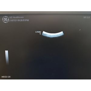 Original Ultrasound Transducer Crystal 4C-RS High Image Quality for GE VividS6