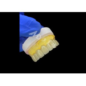 Long-lasting Bonding PFM Dental Crown Bridge With Excellent Biocompatibility