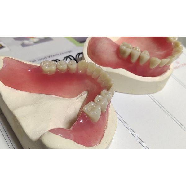 Quality Hot Cured Removable Aesthetic Lower Partial Acrylic Denture wholesale