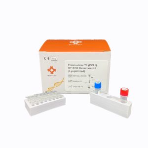 Enterovirus EV71 Real Time PCR Diagnostic RT-PCR Detection Kit Lyophilized