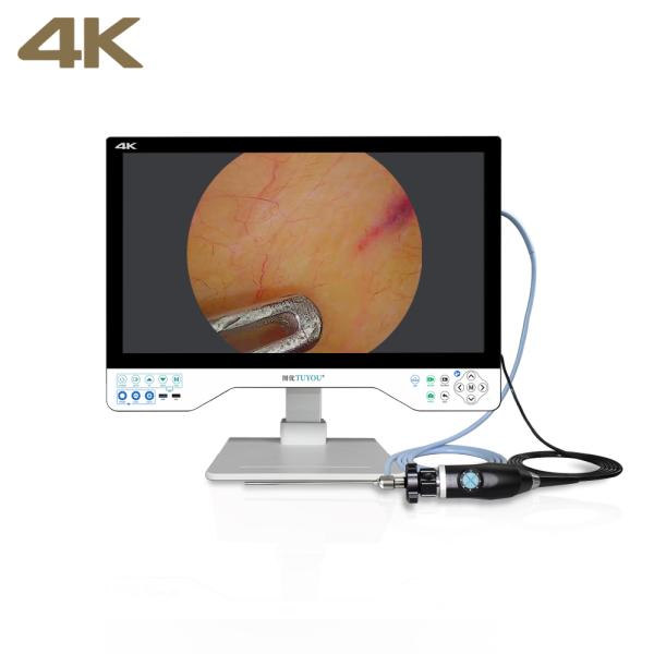 Quality TUYOU All-in-One FHD Endoscopy Camera System with 24" Surgical Monitor for Urology Procedures wholesale