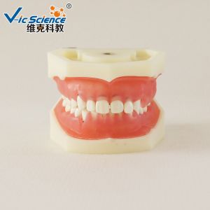 Cheap Professional Medical Dental Study Models VIC-L5 Peridontal Disease Model for sale