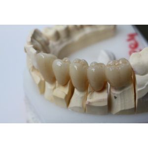 43% Translucent 1100Mpa Dental Zirconia Block Adhesive No Irritation
