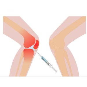 3ml Knee Pain Mesotherapy Solution Non Crosslinked Hyaluronic Acid