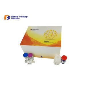 High Precision Human Deoxypyridinoline Crosslinks DPD ELISA Kit 96 Wells