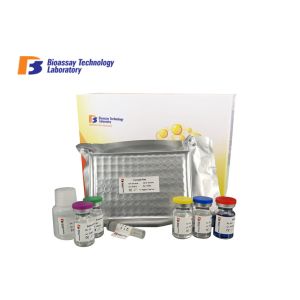 Androstenedione Asd Human Elisa Kit 96 Wells Highly Sensitive For Research