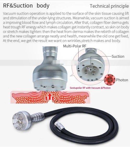 40KHz Body Sculpting Machine Vacuum Ultrasonic Cavitation Radio Frequency Machine