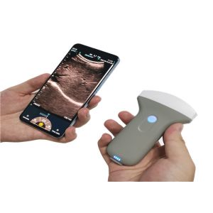Mobilephone Ultrasound Scanner Probe Wireless System With 3.5 MHz Frequency