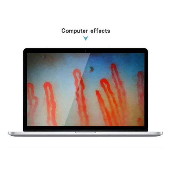 Quality Capillary Microcirculation Medical Microscope Magnification Over 380 Times wholesale