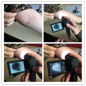 Portable Handheld Microscope Digital Skin Hair Inspector with Measurement