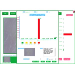 Pocket USB LCD Digital Dermatoscope Skin and Hair Analyzer With Testing Software