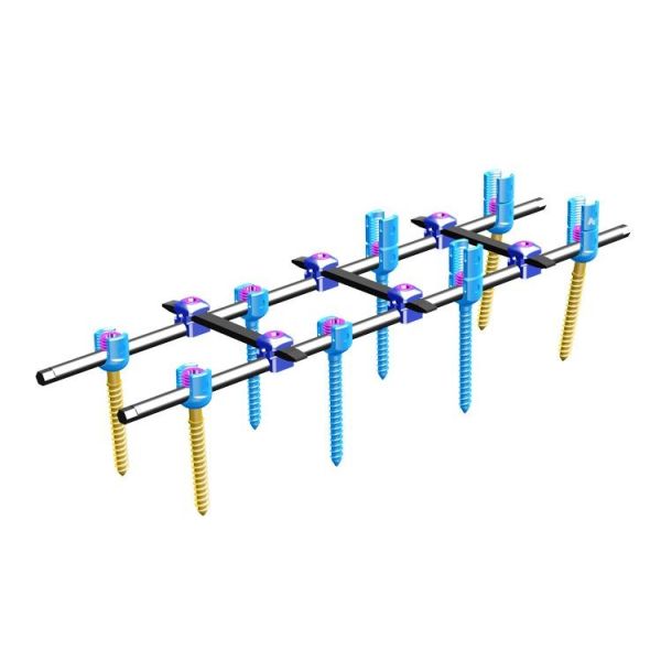 Quality Orthopedics Spinal Internal Fixation Ⅳ Spinal Fixation System wholesale