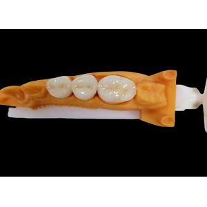 China Wear-Resistant Zirconia Dental Crown with Chip and Stain Resistance and Natural Aesthetics from China dental lab on sale