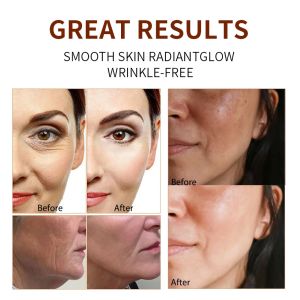 PH5.5 Balanced Skincare Face Serum Niacinamide Serum Sensitive Skin For Dark