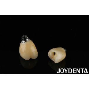 Porcelain Implant Crown and Bridge The Ultimate Solution for Restoration Of