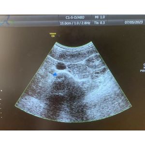 GE C1-5-D Convex Ultrasound Transducer Probe Ultrasonic Machine Parts