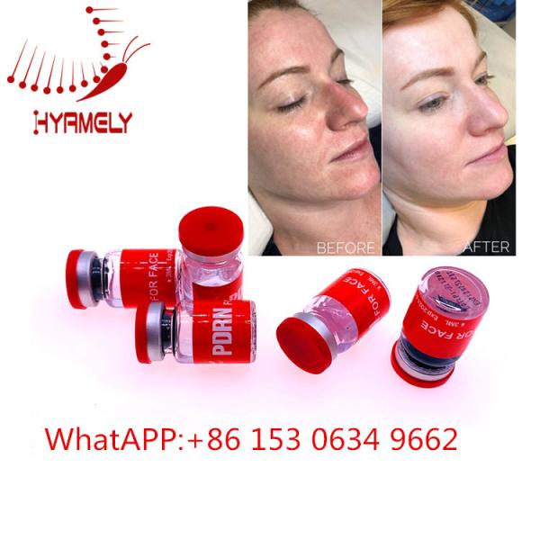 Quality Anti Aging Meso Serum Injection With Hyaluron Pen Dermal Filler wholesale