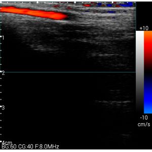 USB Color Handheld Ultrasound Scanner , Portable Ultrasound Device Lightweight