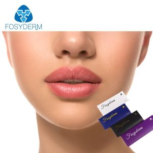 Derm Cross Linked Hyaluronic Acid Injectable Lip Fillers 1ml 2ml CE ISO