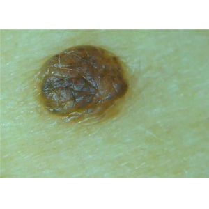 Wireless Microscope Camera Digital Video Dermatoscope Skin And Hair Analysis