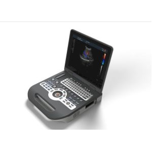 4d Ultrasound Machine Portable Ultrasound Scanner With 120G Capacity 4800 Frames
