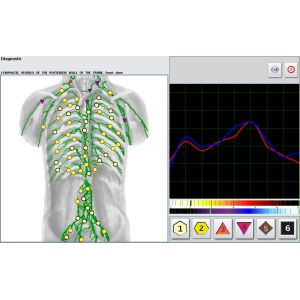 4025 Metatron NLS Machine Holistic Practitioners and Naturopathic Biofeedback
