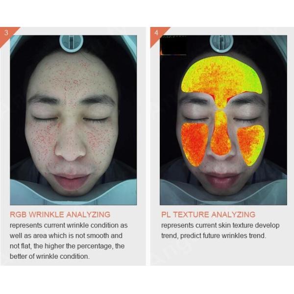 Quality Handheld Wireless Wifi 3d Skin Analysis Machine Digital With Video Microscope wholesale