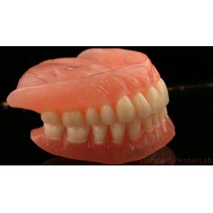 China Heat Cured Ivoclar Full Acrylic Denture Dental Lab High Accuracy High Esthetic Advantage on sale