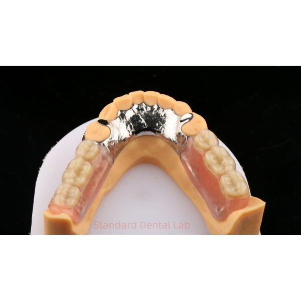 Quality Metal Alloys Cobalt Chromium Partial Denture Ivoclar Scheftner Comfortable Cast Metal Framewrok wholesale