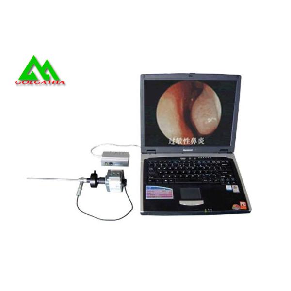 Quality Endoscopic Sinus Surgery Endoscope / Waterproof Camera Video Endoscopy wholesale