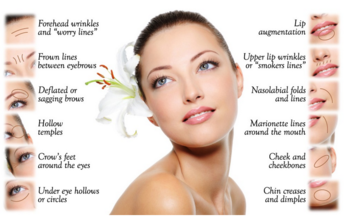 Cross Linked Hyaluronic Acid Wrinkle Fillers , Dermal Skin Fillers For Wrinkles