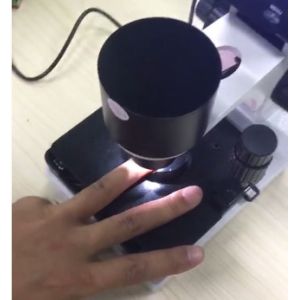 Next Generation Microcirculation Microscope , Blood Vessel Microscope For
