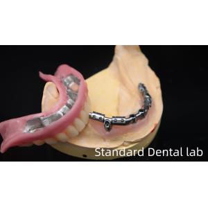 Titanium Implant Supported Dentures Precise Ivoclar Denture Over Implants