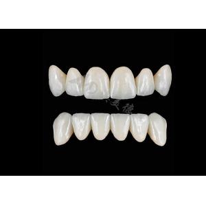 Translucency Natural Esthetic Zirconia Crowns Excellent Biocompatibility And