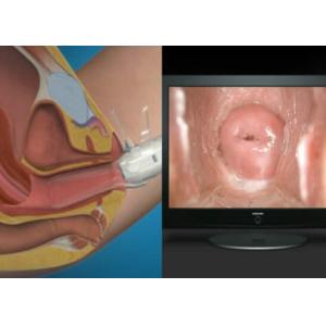 High Definition Video Gynecological Apparatus Digital Electronic Colposcope AV