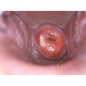 Vaginal Camera Cervix Camera Digital Electronic Video Colposcope for Gyneclogy