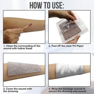 Chinese supplier soft Bacteriostatic Silver Calcium Alginate Dressing