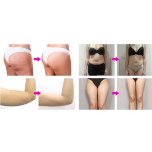 Cavitation 6 In 1 Endosphere Machine For Fat Loss Muscle Building