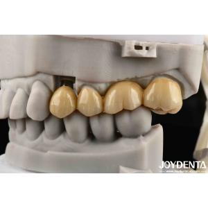 Multilayer Full Zirconia High Resistance To Cracking And Durability For Long
