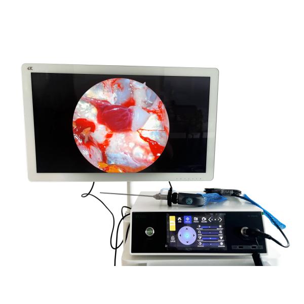 Quality Full HD 1080P ENT Portable Endoscopy Camera With Touchscreen And LED Light Source wholesale