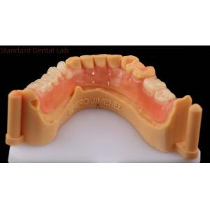 Dental TCS Valplast Flexible Partial Dentures Dental Lab 3D Print Model High