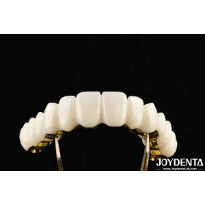 China Custom Made Zirconia Excellent Strength For Individualized Dental Solutions on sale