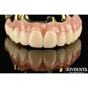 Restoring Chewing Function Ti-Bar Zirconia Hybrid Bridge With High Biocompatibil