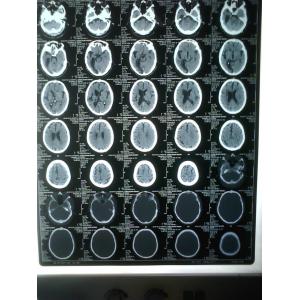 China Medical Dry Thermal PET X Ray Film , Agfa Drystar DT2B Fuji Drypix on sale