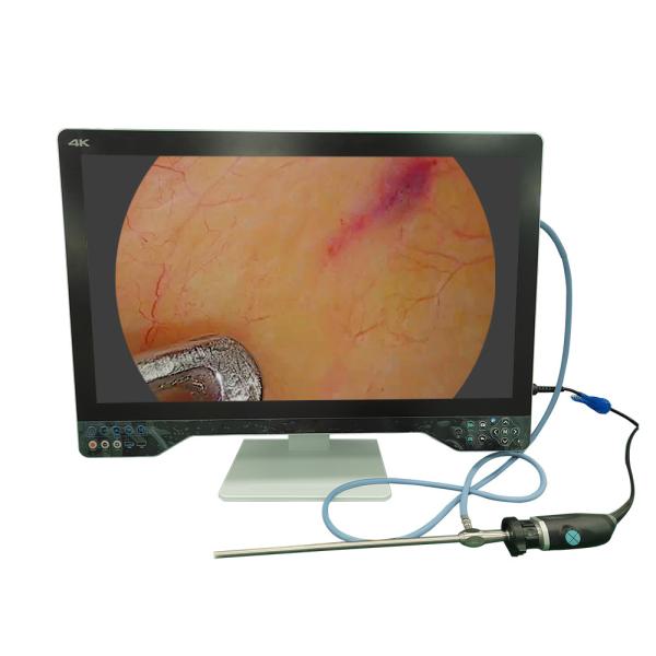 Quality TUYOU 32" 4K Medical ENT Endoscope Camera System Complete with USB Laparoscopic Function, Light Source & Monitor wholesale