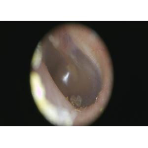 3.5” Full Color TFT-LCD Digital Video ENT Examination Unit Ear Throat Nosal Skin